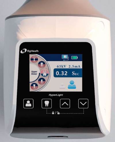 Мобільний переносний пересувний портативний рентген апарат HyperLight - купити в MDS