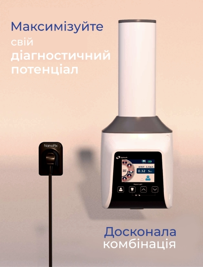 Інновації в стоматології - стоматологічна діагностика нового рівня - цифровий рентген діагностика зубів