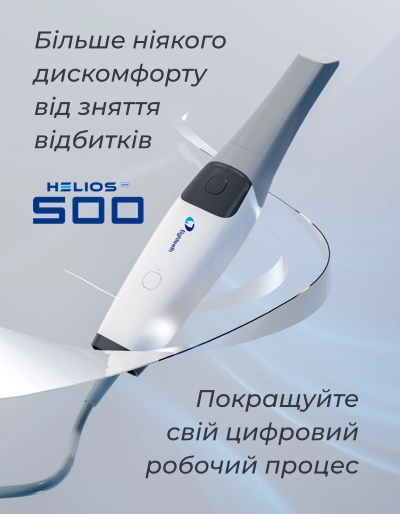 Інновації в стоматології - стоматологічна діагностика нового рівня - Цифровий відбиток зубів