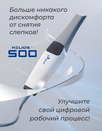 Цифровая стоматология и новые технологии - цифровой оттиск или отпечаток без слепков